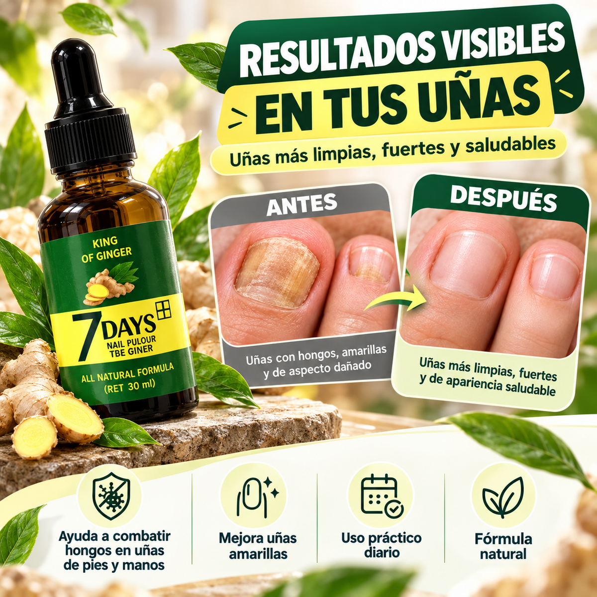 Tratamiento para Hongos y Uñas Amarillas | Uñas Más Fuertes desde 7 Días