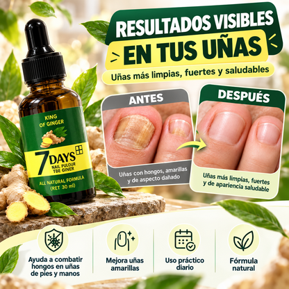 Tratamiento para Hongos y Uñas Amarillas | Uñas Más Fuertes desde 7 Días