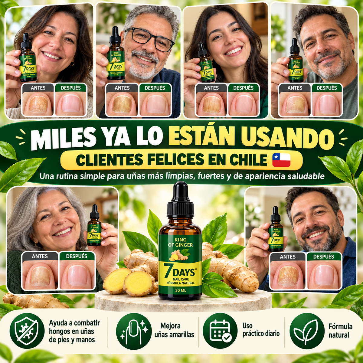 Tratamiento para Hongos y Uñas Amarillas | Uñas Más Fuertes desde 7 Días